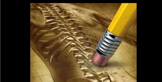 Osteoporosis Prevention